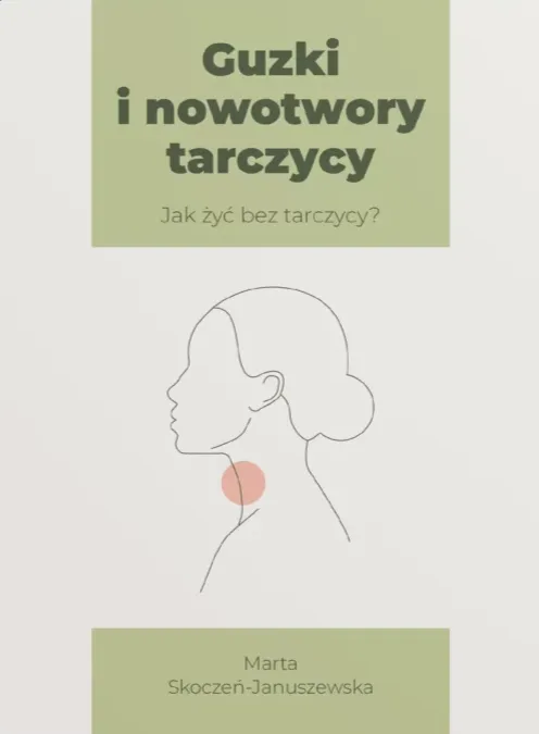Guzki i nowotwory tarczycy. Jak żyć bez tarczycy? — Marta Skoczeń-Januszewska